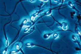 Spermatozoïdes humains / © R. Wagner, W. Bettigofer, J.-M. Babalian, P. Galliker et R. Birke/P. ArnolD (biosphoto)