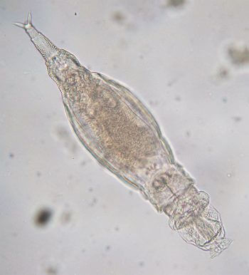Rotifère Rotifères, nématodes et cie... habitants de l'eau