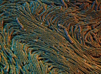 Colonie de bactéries Tout savoir sur les bactéries et champignons du sol