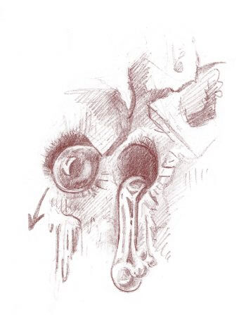 Trous pratiqués par un pic tridactyle pour extraire la sève de l'arbre. Dessin de trous pratiqués par un pic tridactyle pour extraire la sève de l'arbre.