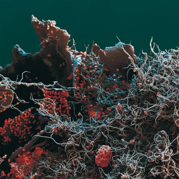 Zoom microscopique ( grandi 160 fois) sur une fructification de Metatrichia floriformis épanouie sur un morceau de bois mort. Les spores paraissent emmêlées dans une pelote de laine. Ces filaments vont comme des ressorts projeter les spores en l’air. Planant - La Salamandre