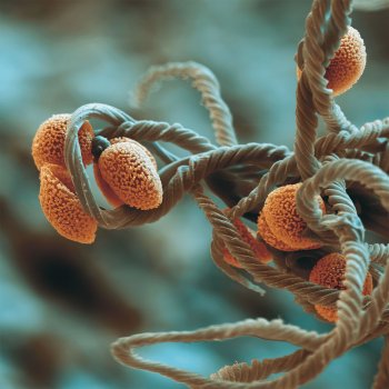 Zoom microscopique (grandi 2000 fois) sur une fructification de Metatrichia floriformis épanouie sur un morceau de bois mort. Les spores paraissent emmêlées dans une pelote de laine. Ces filaments vont comme des ressorts projeter les spores en l’air.