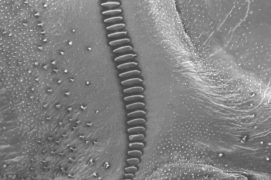 Voici les dents stridulatoires de la decticelle chagrinée agrandies au microscope électronique. / © Jean Wuest
