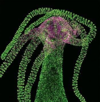 Voici les neurones de l'hydre colorés en violet grâce à un marqueur fluorescent. La science va-t-elle pouvoir rendre l'humain immortel